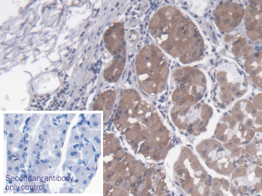 Polyclonal Antibody to Protein Kinase N1 (PKN1)