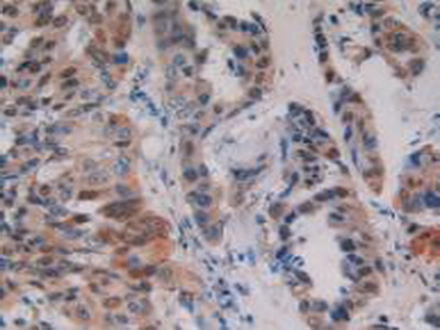 Polyclonal Antibody to Protein Kinase D1 (PKD1)