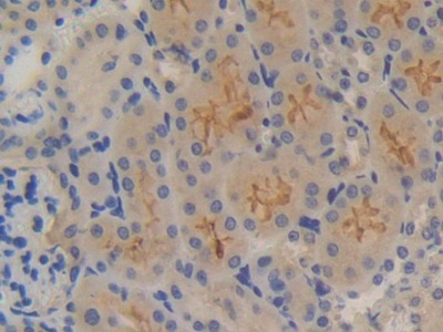 Polyclonal Antibody to Protein Kinase D2 (PKD2)