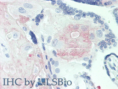 Polyclonal Antibody to Fibrinogen Like Protein 2 (FGL2)