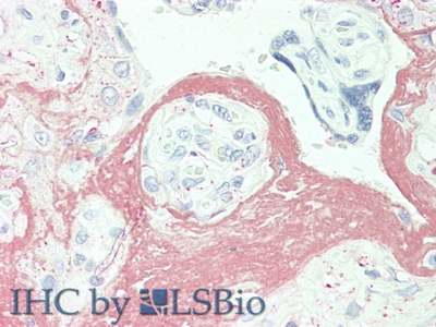 Polyclonal Antibody to Fibrinogen Like Protein 2 (FGL2)