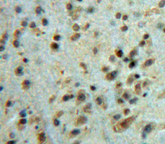 Polyclonal Antibody to Ataxin 1 (ATXN1)