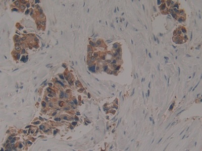 Polyclonal Antibody to Cytokeratin 16 (CK16)