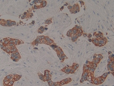 Polyclonal Antibody to Cytokeratin 15 (CK15)