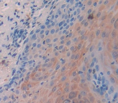 Polyclonal Antibody to Cytokeratin 14 (CK14)