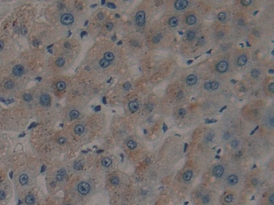 Polyclonal Antibody to Tissue Plasminogen Activator (tPA)