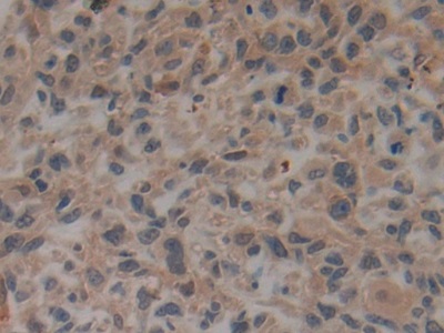 Polyclonal Antibody to Tissue Plasminogen Activator (tPA)