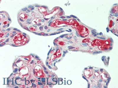 Polyclonal Antibody to Tissue Plasminogen Activator (tPA)