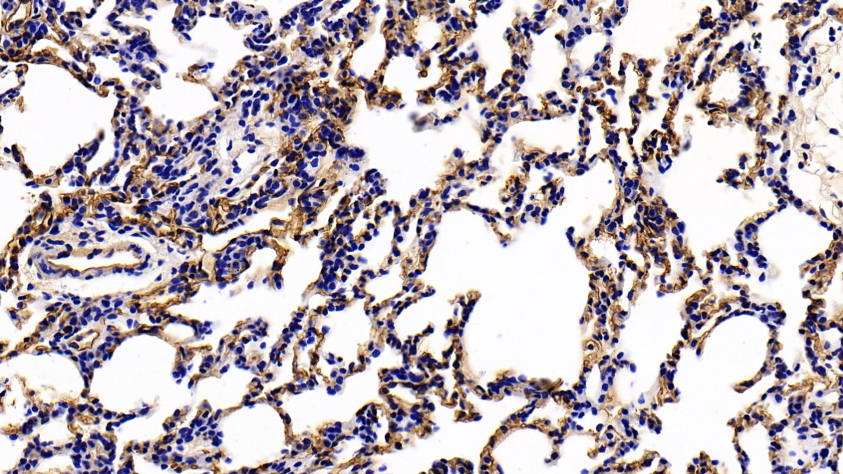 Polyclonal Antibody to Thrombomodulin (TM)