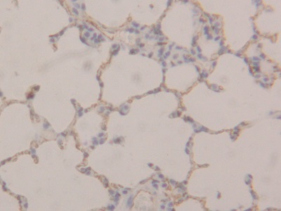 Polyclonal Antibody to Thrombomodulin (TM)