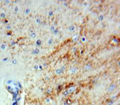 Polyclonal Antibody to Plasminogen Activator Inhibitor 2 (PAI2)