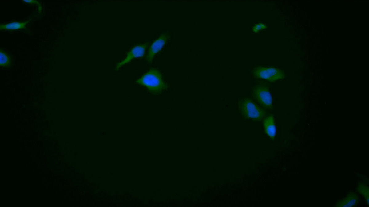 Polyclonal Antibody to Plasminogen Activator Inhibitor 2 (PAI2)