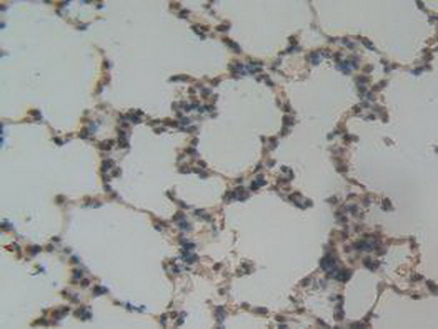 Polyclonal Antibody to Plasminogen Activator Inhibitor 1 (PAI1)