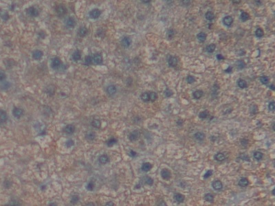 Polyclonal Antibody to Leucine Aminopeptidase (LAP)