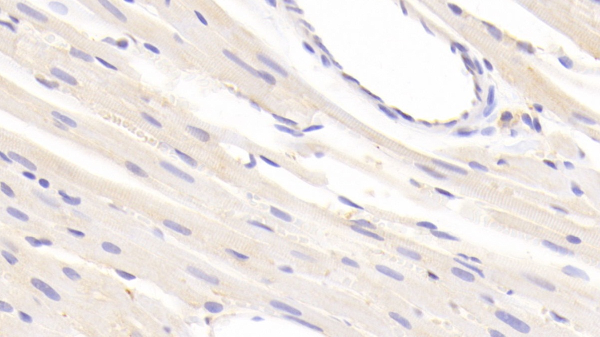 Polyclonal Antibody to Leucine Aminopeptidase (LAP)