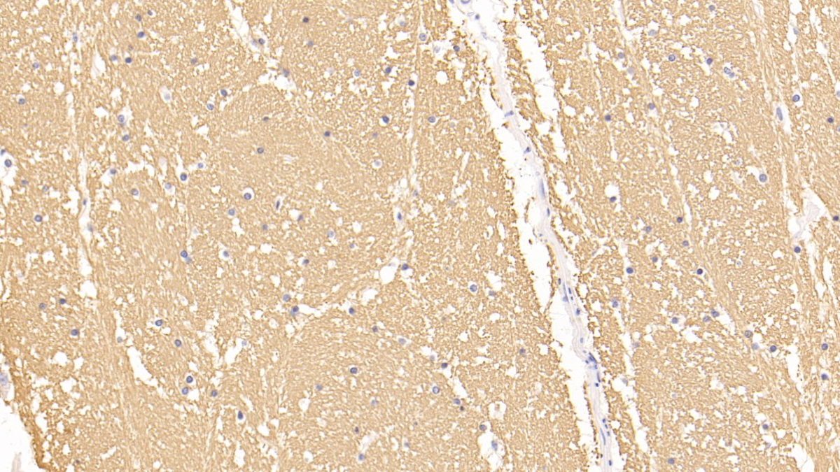 Polyclonal Antibody to Myelin Basic Protein (MBP)