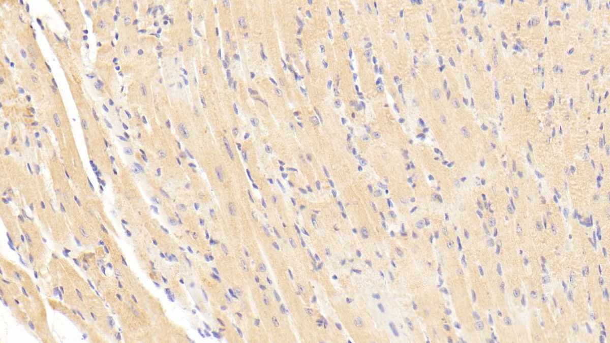 Polyclonal Antibody to Brain Natriuretic Peptide (BNP)