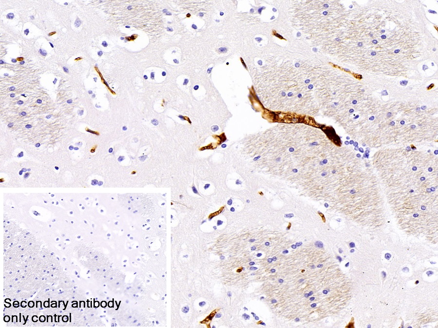 Polyclonal Antibody to Immunoglobulin G (IgG)