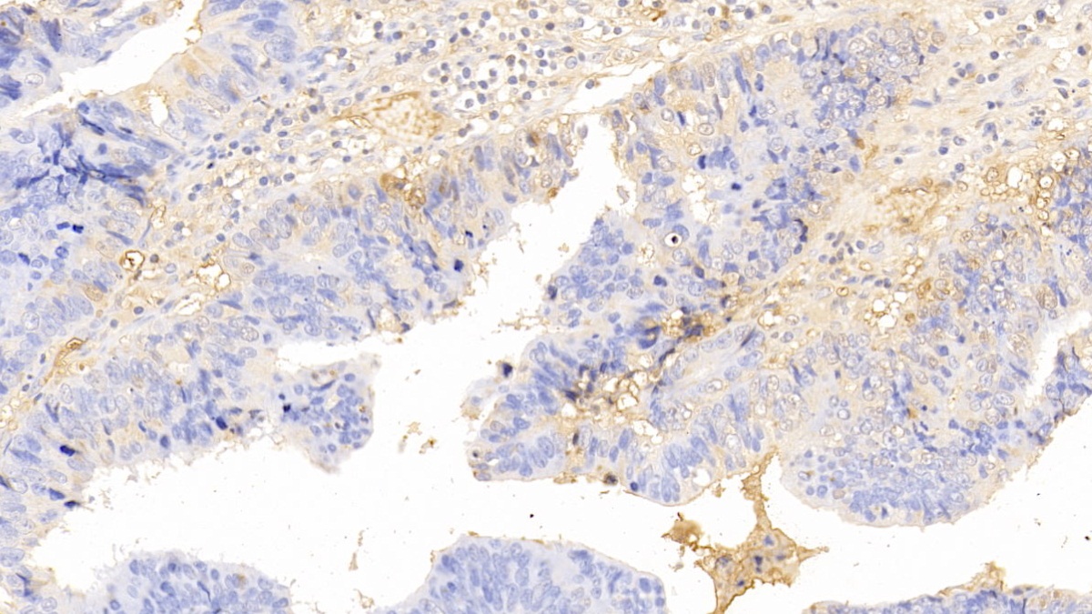 Polyclonal Antibody to Immunoglobulin A (IgA)