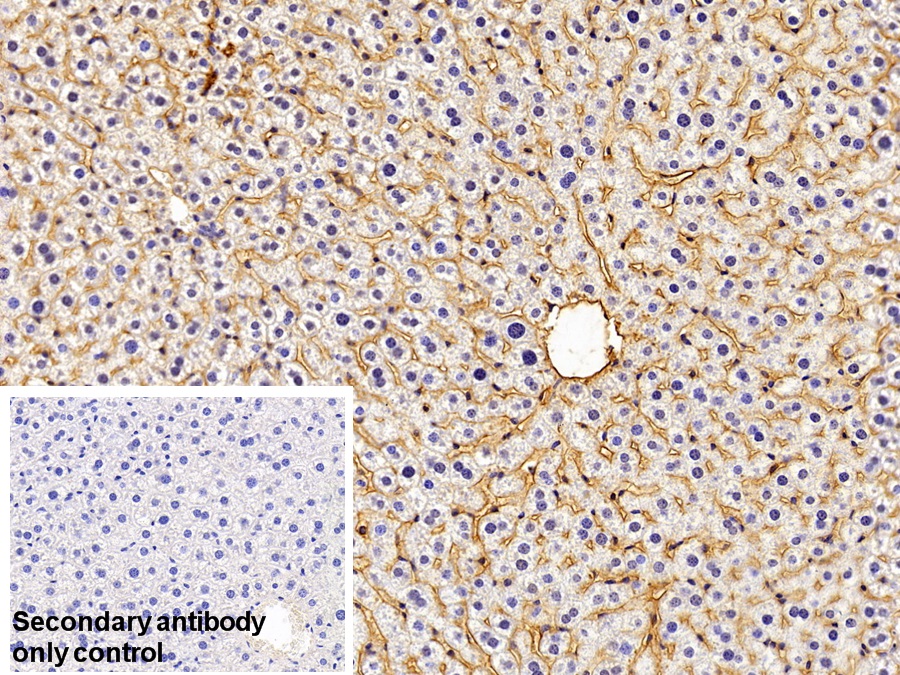 Polyclonal Antibody to Intercellular Adhesion Molecule 1 (ICAM1)