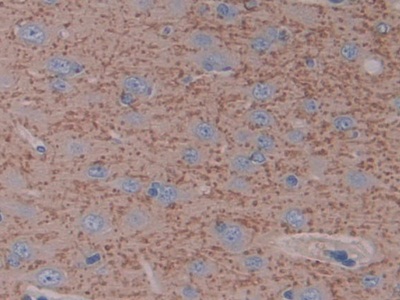 Polyclonal Antibody to Intercellular Adhesion Molecule 1 (ICAM1)