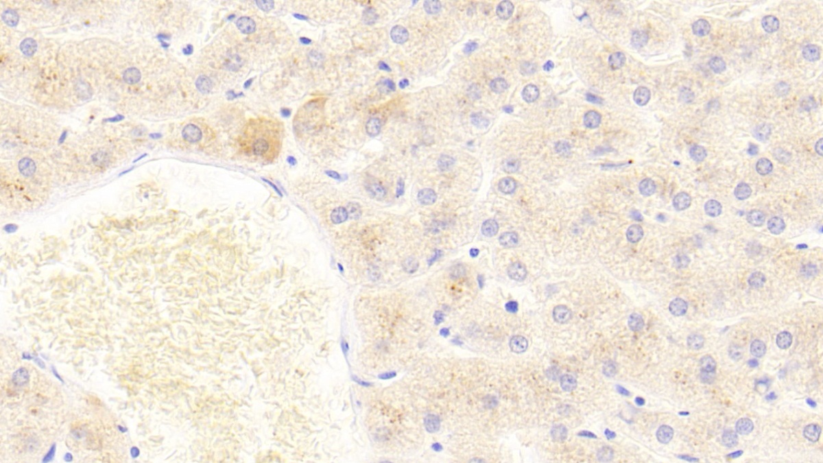 Polyclonal Antibody to Fibroblast Growth Factor 2, Basic (FGF2)