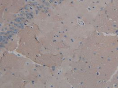 Polyclonal Antibody to Fibroblast Growth Factor 2, Basic (FGF2)