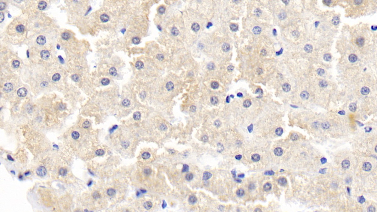 Polyclonal Antibody to Tissue Inhibitors Of Metalloproteinase 1 (TIMP1)