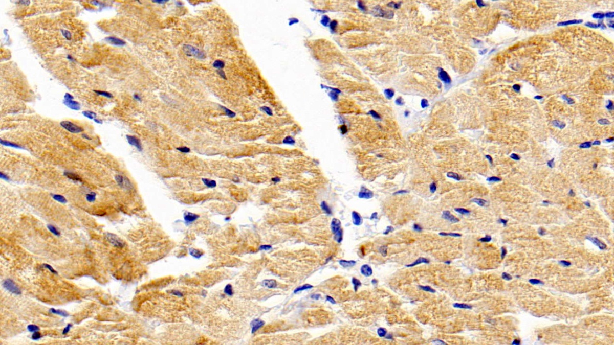 Polyclonal Antibody to Matrix Metalloproteinase 9 (MMP9)