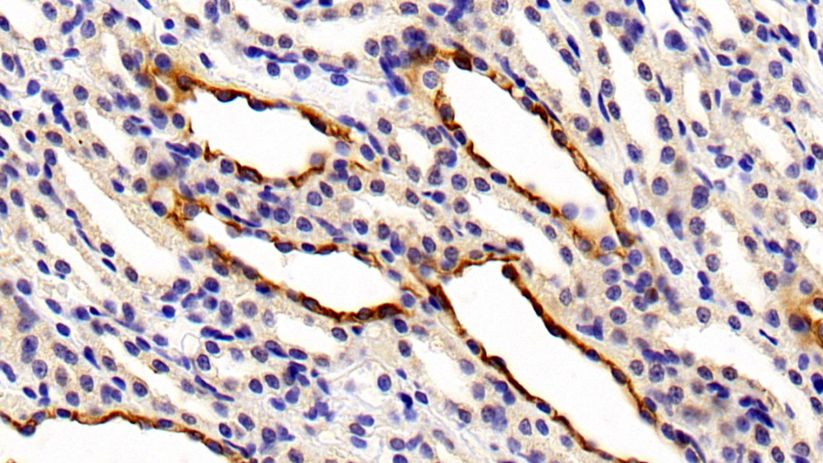 Polyclonal Antibody to Cytokeratin 7 (CK7)