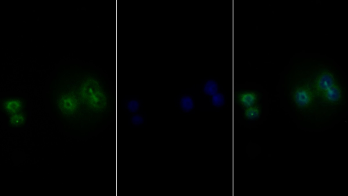 Polyclonal Antibody to Leukemia Inhibitory Factor Receptor (LIFR)