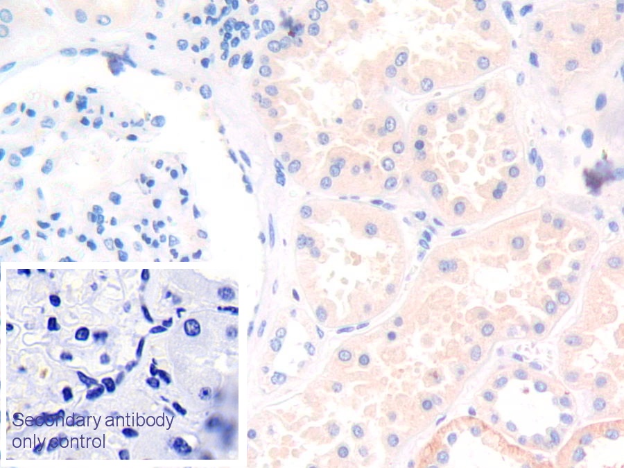 Polyclonal Antibody to Leukemia Inhibitory Factor Receptor (LIFR)