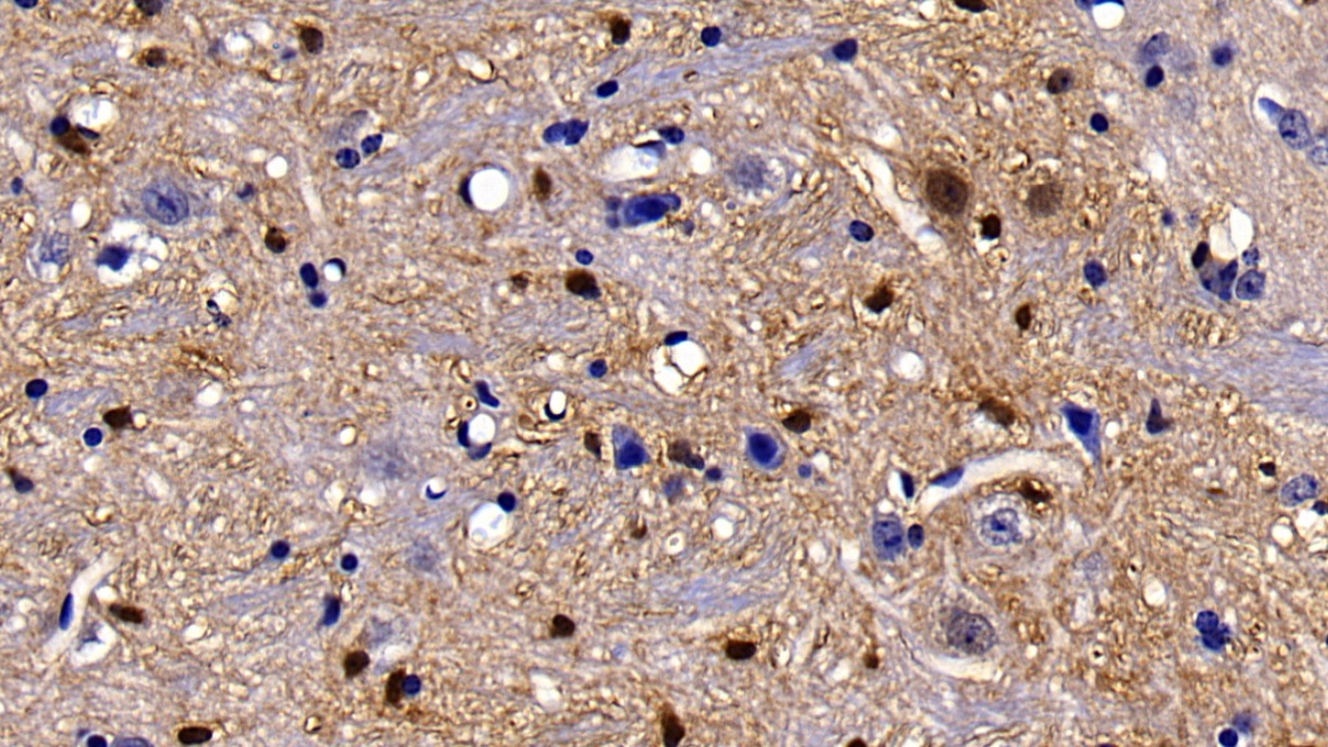 Polyclonal Antibody to S100 Calcium Binding Protein B (S100B)