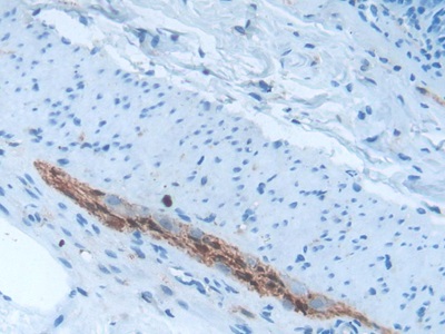 Polyclonal Antibody to S100 Calcium Binding Protein B (S100B)