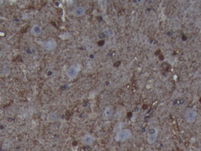 Polyclonal Antibody to S100 Calcium Binding Protein B (S100B)