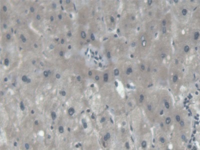 Polyclonal Antibody to Procollagen III N-Terminal Propeptide (PIIINP)