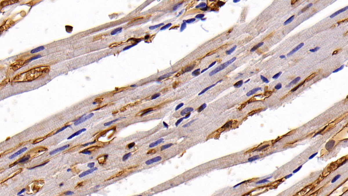 Polyclonal Antibody to Aquaporin 1 (AQP1)