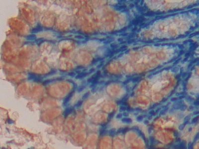 Polyclonal Antibody to Cyclin D2 (CCND2)