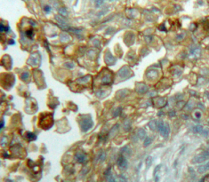 Polyclonal Antibody to Cyclin D3 (CCND3)