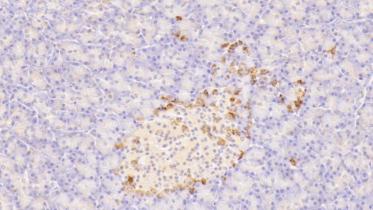 Polyclonal Antibody to Somatostatin (SST)