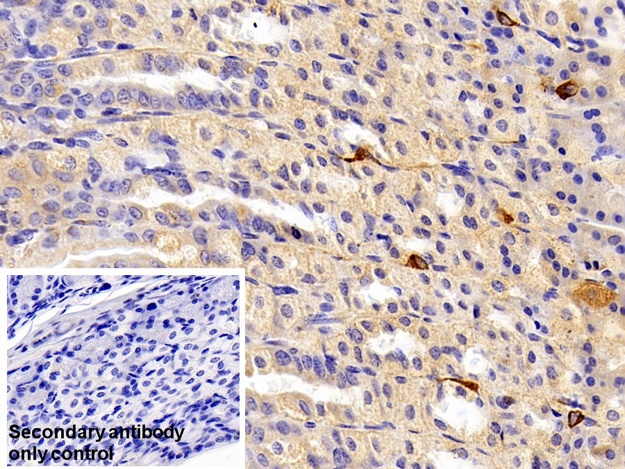 Polyclonal Antibody to Somatostatin (SST)