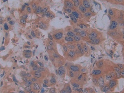 Polyclonal Antibody to Fibrillin 1 (FBN1)