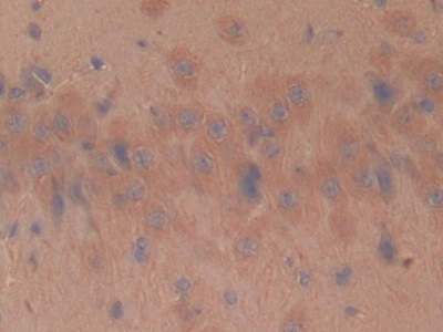 Polyclonal Antibody to Fibrillin 1 (FBN1)