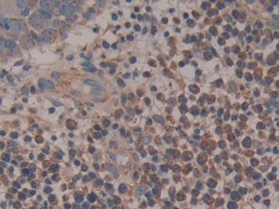 Polyclonal Antibody to Cytochrome C (CYCS)