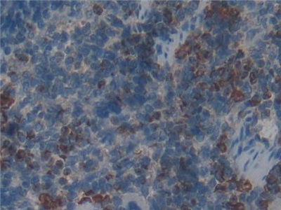 Polyclonal Antibody to Myeloperoxidase (MPO)