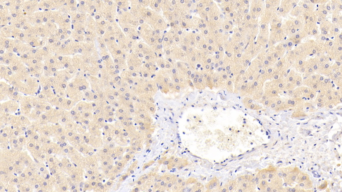 Polyclonal Antibody to Peroxisomal Biogenesis Factor 2 (PEX2)