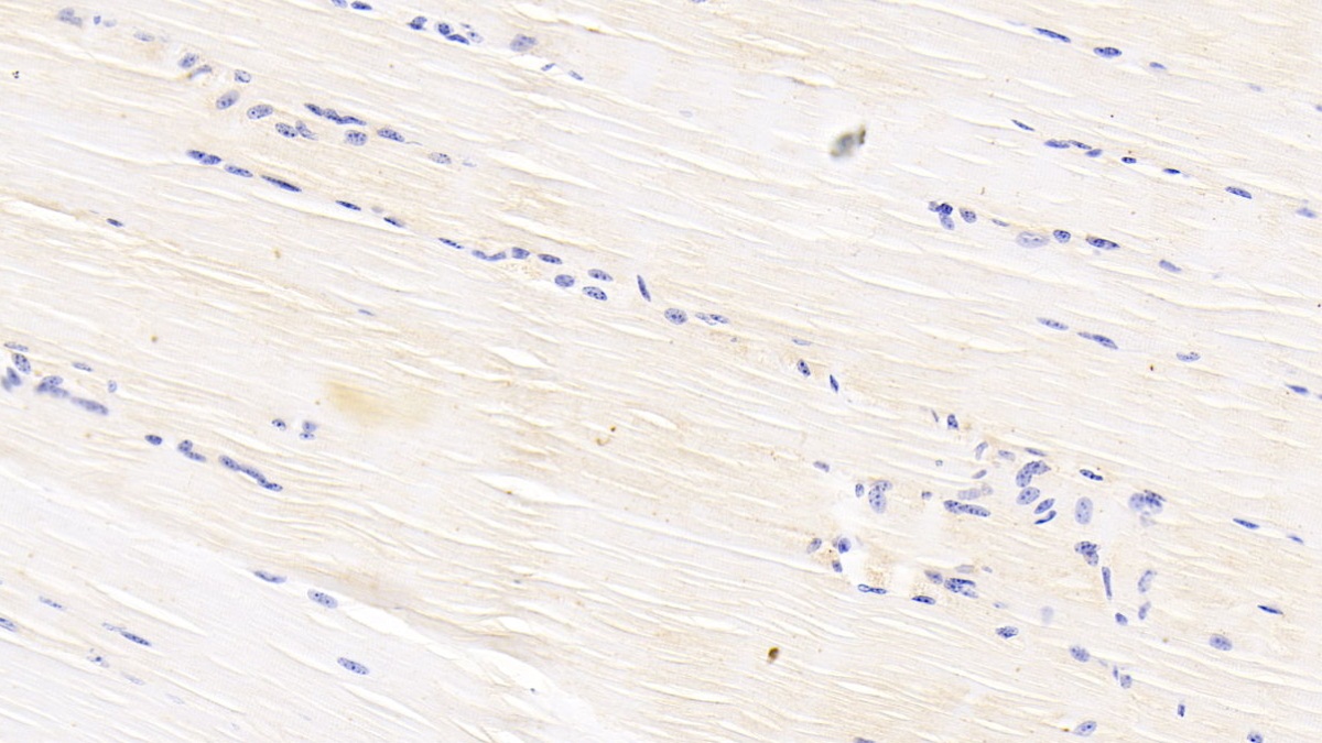 Polyclonal Antibody to Apolipoprotein B100 (APOB100)