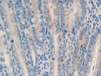 Polyclonal Antibody to Microsomal Glutathione S Transferase 1 (MGST1)