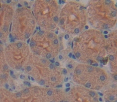 Polyclonal Antibody to Thrombospondin 1 (THBS1)