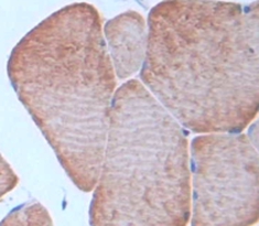 Polyclonal Antibody to Thrombospondin 1 (THBS1)